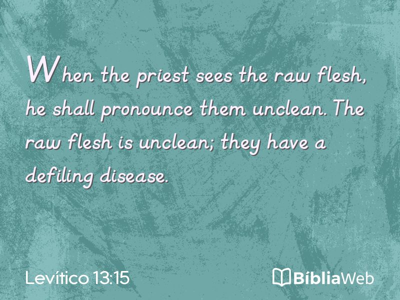 Levítico 13:15 em imagem para compartilhar
