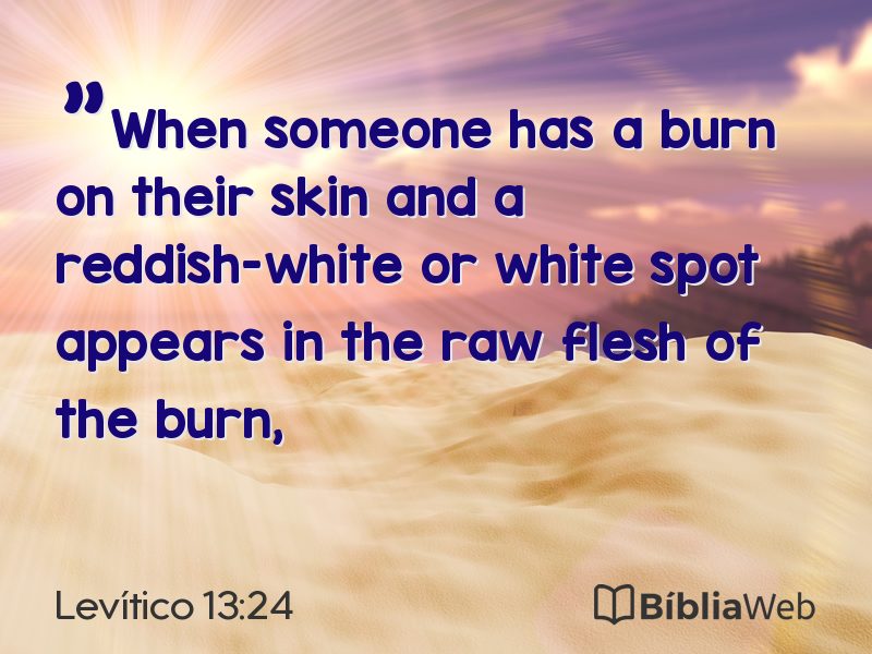 Levítico 13:24 em imagem para compartilhar
